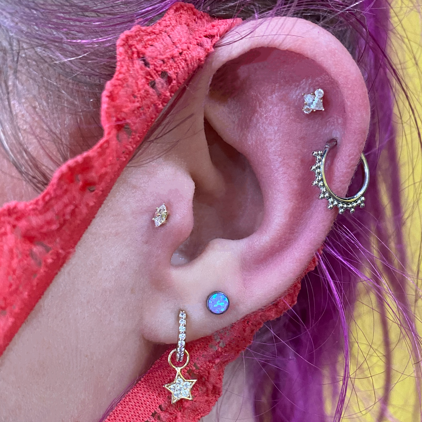 Helix (Ear Cartilage)